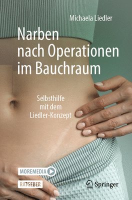 Narben nach Operationen im Bauchraum 1