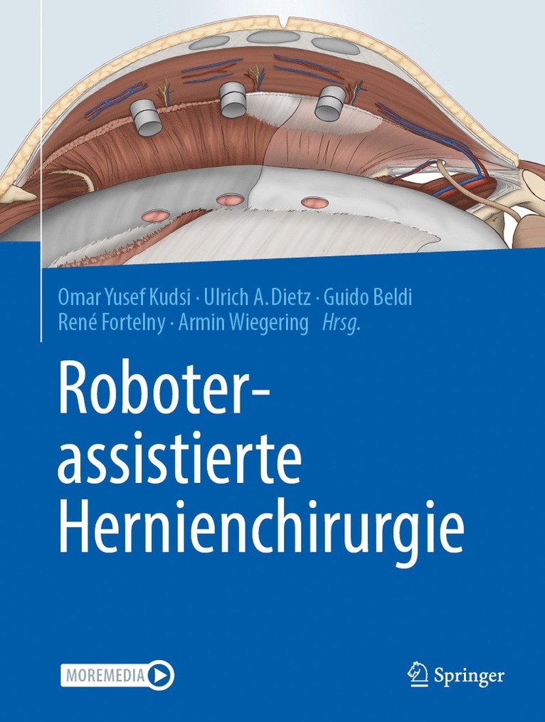 Roboterassistierte Hernienchirurgie 1