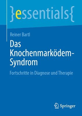 Reiner Bartl - Das Knochenmarködem-Syndrom, Häftad
