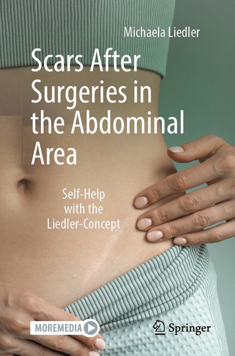 Michaela Liedler - Scars After Surgeries in the Abdominal Area, Häftad