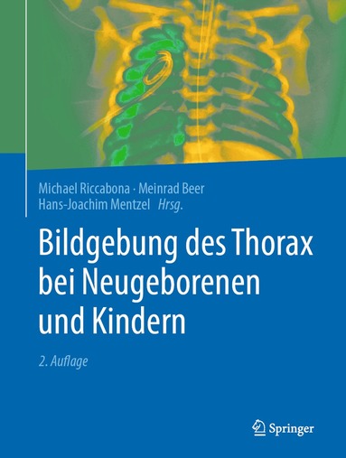Michael Riccabona, Meinrad Beer, Hans-Joachim Mentzel - Bildgebung des Thorax bei Neugeborenen und Kindern, Inbunden
