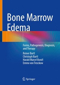 bokomslag Bone Marrow Edema