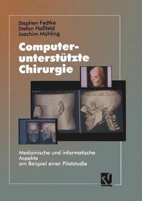 bokomslag Computeruntersttzte Chirurgie