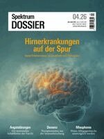 Spektrum der Wissenschaft - Spektrum Dossier 4/2026 Hirnerkrankungen auf der Spur, Häftad. Tillgänglighet: Lägg i varukorg