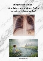 Horst Fischer - Lungensteckschuss - Mein Leben am seidenen Faden zwischen Leben und Tod, Häftad