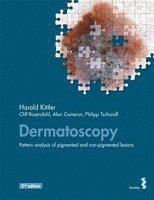 bokomslag Dermatoscopy: Pattern analysis of pigmented and non-pigmented lesions