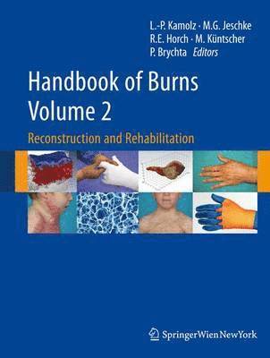 Lars-Peter Kamolz, Marc G. Jeschke - Handbook of Burns, Volume 2: Reconstruction and Rehabilitation, Inbunden