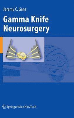 Gamma Knife Neurosurgery 1