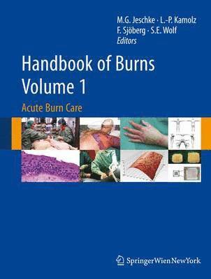Marc G. Jeschke, Lars-Peter Kamolz - Handbook of Burns, Volume 1: Acute Burn Care, Inbunden