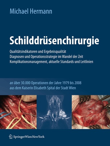 Michael Hermann - Schilddrüsenchirurgie - Qualitätsindikatoren und Ergebnisqualität, Diagnosen und Operationsstrategie im Wandel der Zeit, Komplikationsmanagement, aktuelle Standards und Leitlinien, Inbunden