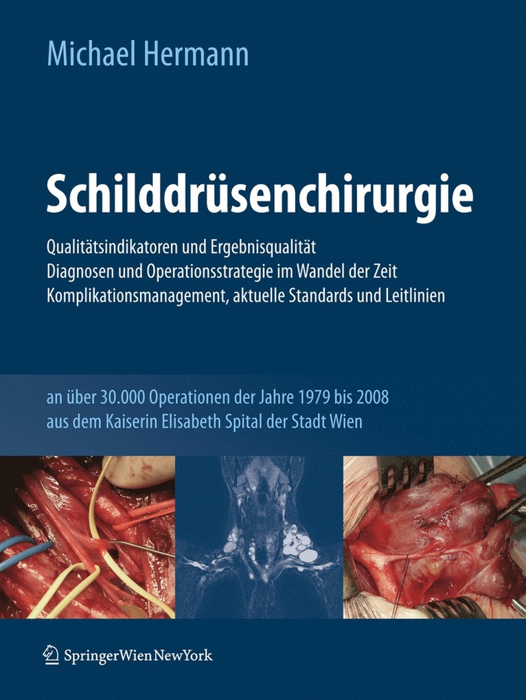 Schilddrüsenchirurgie - Qualitätsindikatoren und Ergebnisqualität, Diagnosen und Operationsstrategie im Wandel der Zeit, Komplikationsmanagement, aktuelle Standards und Leitlinien