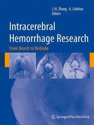 Intracerebral Hemorrhage Research 1