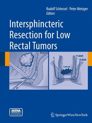 Intersphincteric Resection for Low Rectal Tumors 1