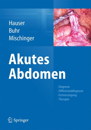 bokomslag Akutes Abdomen