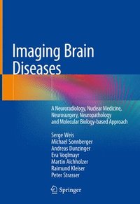 bokomslag Imaging Brain Diseases