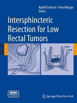 bokomslag Intersphincteric Resection for Low Rectal Tumors