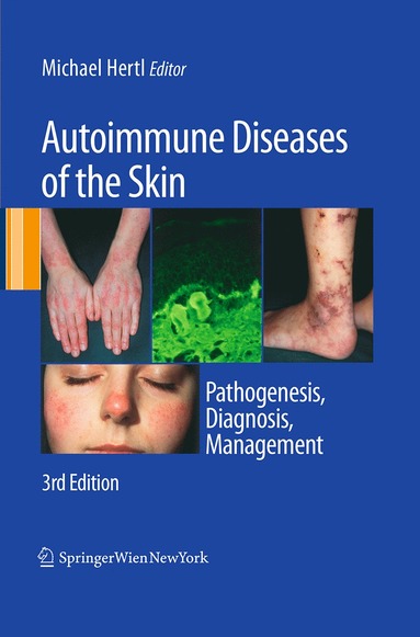 bokomslag Autoimmune Diseases of the Skin