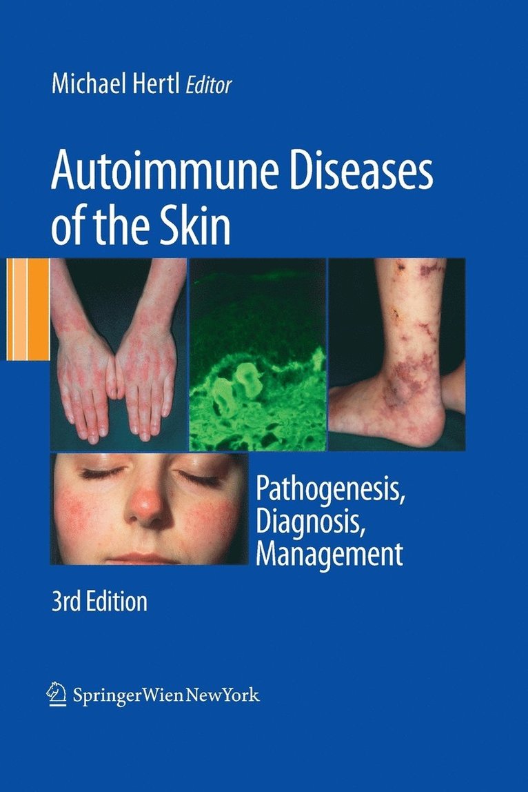 Autoimmune Diseases of the Skin 1