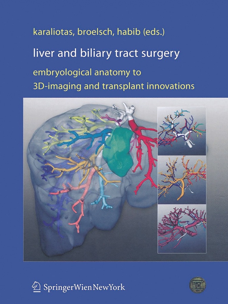 Constantine C. Karaliotas, Christoph E. Broelsch, Nagy A. Habib - Liver and Biliary Tract Surgery, Häftad