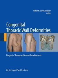 bokomslag Congenital Thoracic Wall Deformities