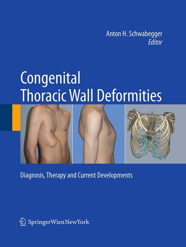 bokomslag Congenital Thoracic Wall Deformities