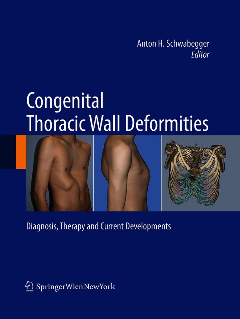 Anton H. Schwabegger - Congenital Thoracic Wall Deformities, Häftad