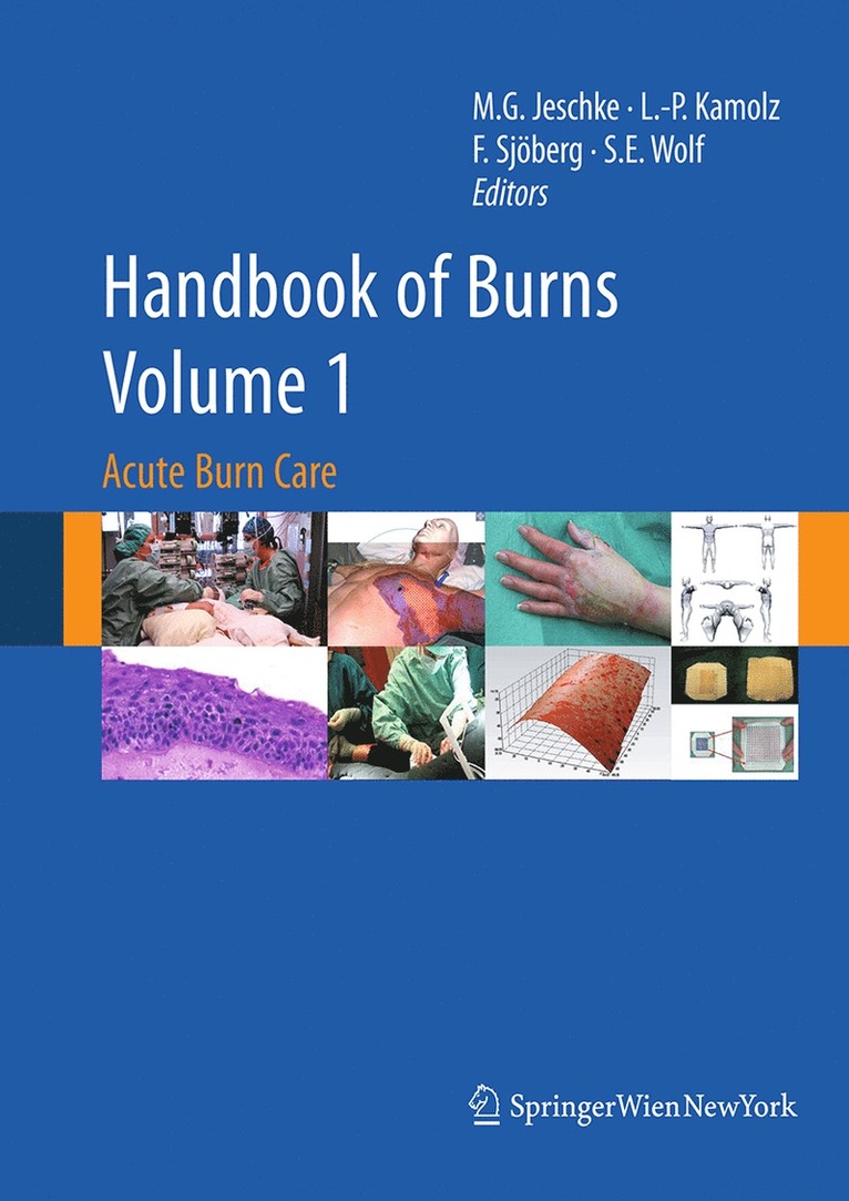 Marc G. Jeschke, Lars-Peter Kamolz, Folke Sjöberg, Steven E. Wolf, Folke Sjoberg - Handbook of Burns Volume 1, Häftad