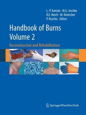 Handbook of Burns Volume 2 1