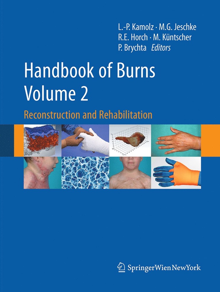 Handbook of Burns Volume 2 1