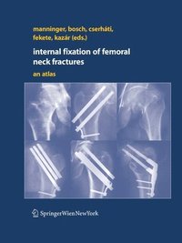 bokomslag Internal fixation of femoral neck fractures