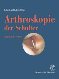 bokomslag Arthroskopie der Schulter