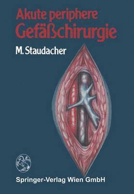 bokomslag Akute periphere Gefäßchirurgie