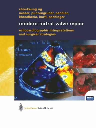 bokomslag Modern Mitral Valve Repair