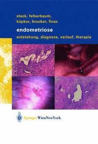 bokomslag Endometriose