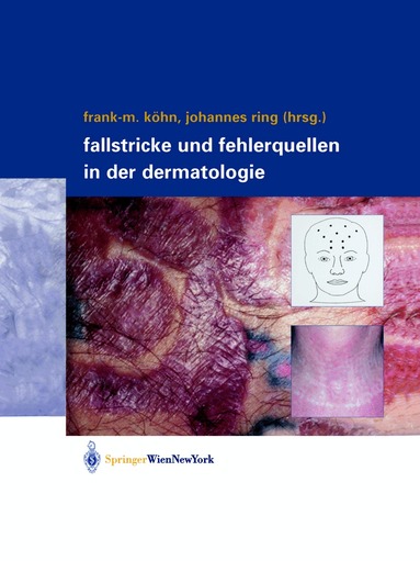 Frank-Michael Köhn, Johannes Ring - Fallstricke und Fehlerquellen in der Dermatologie, Häftad