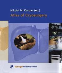 bokomslag Atlas of Cryosurgery
