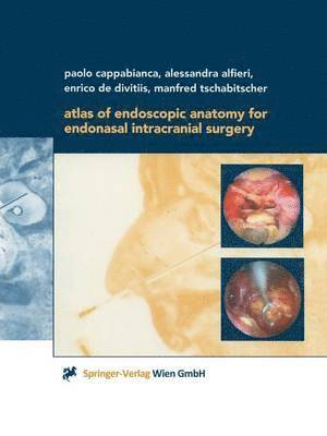 bokomslag Atlas of Endoscopic Anatomy for Endonasal Intracranial Surgery