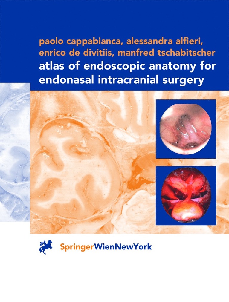 Atlas of Endoscopic Anatomy for Endonasal Intracranial Surgery 1