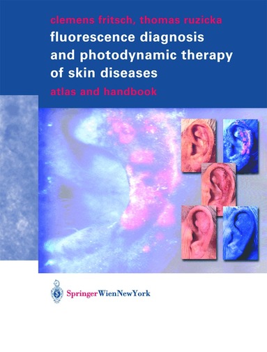 Clemens Fritsch, Thomas Ruzicka - Fluorescence Diagnosis and Photodynamic Therapy of Skin Diseases, Häftad