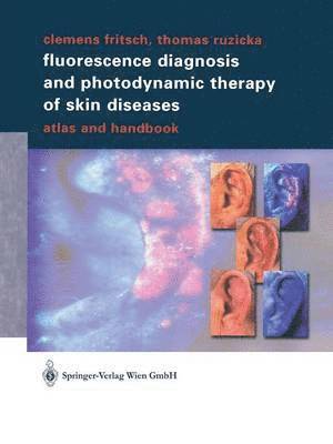 bokomslag Fluorescence Diagnosis and Photodynamic Therapy of Skin Diseases