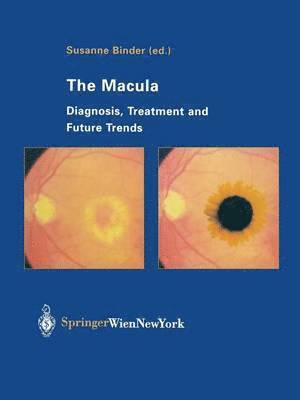 bokomslag Macula