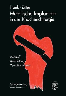 Metallische Implantate in der Knochenchirurgie 1