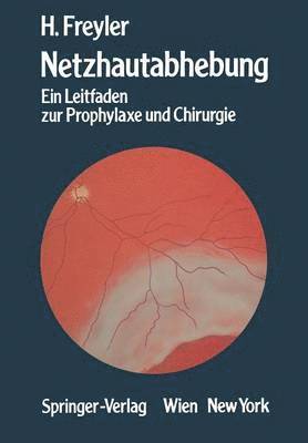 Netzhautabhebung 1