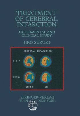 Treatment of Cerebral Infarction 1