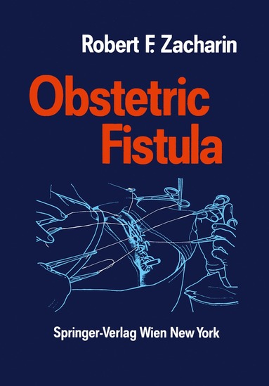 bokomslag Obstetric Fistula