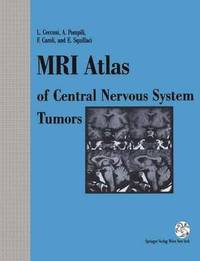 bokomslag MRI Atlas of Central Nervous System Tumors