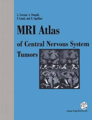 MRI Atlas of Central Nervous System Tumors 1