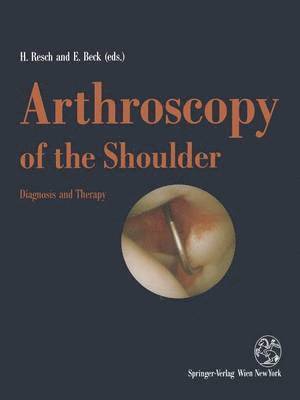 Arthroscopy of the Shoulder 1