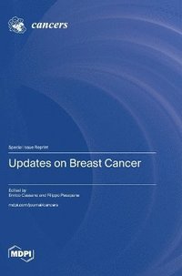 bokomslag Updates on Breast Cancer