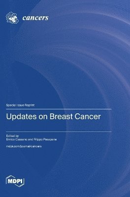 bokomslag Updates on Breast Cancer